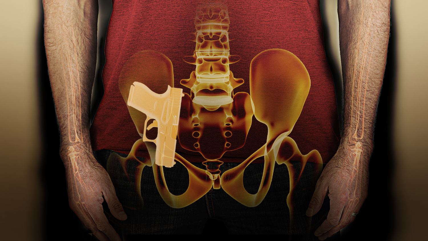 Appendix Carry vs Hip Carry  Difference Between Appendix vs